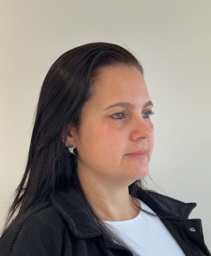 Antes do Full Face, do mesmo caso apresentado pela clínica